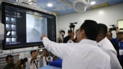 Layanan Stroke dan Jantung Tanpa Biaya, RSUD Kota Tangerang Hadirkan Teknologi Canggih